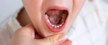 Źródło stanu zdrowia jamy ustnej